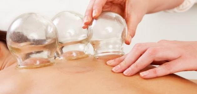 الحجامه العلاجيه للنساء